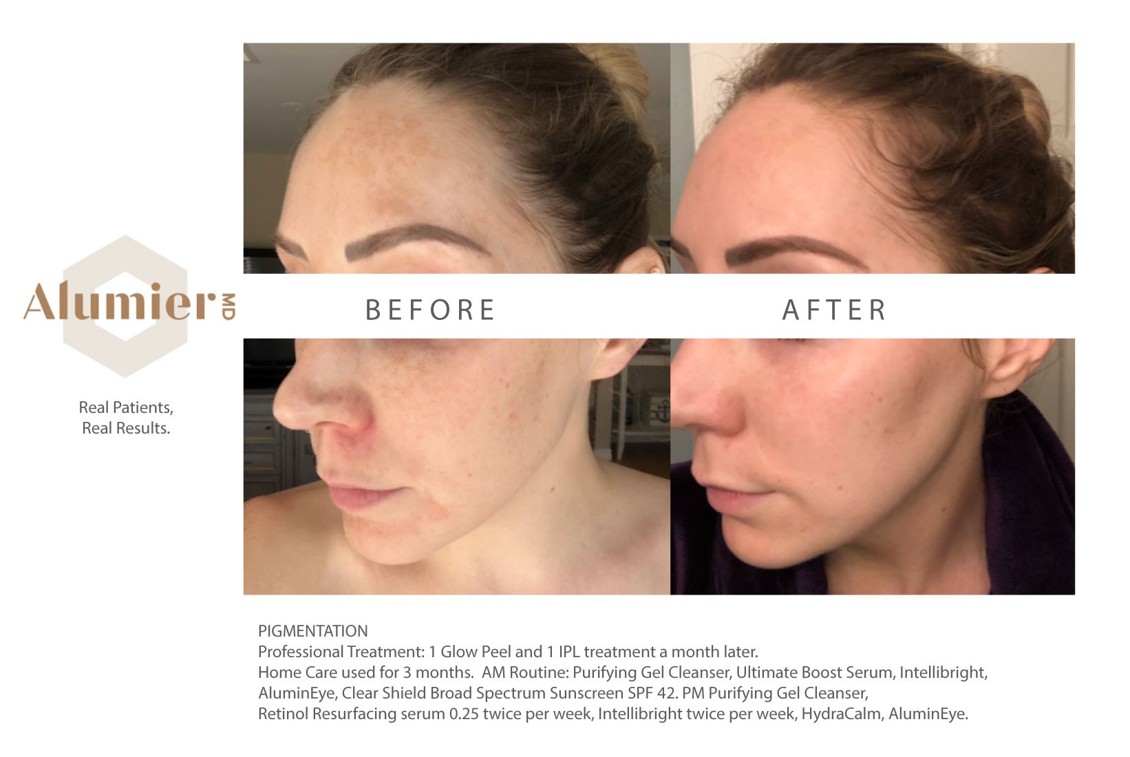 Eye-safe medical grade Skincare in Lakeland, FL - Eyes on Lakeland